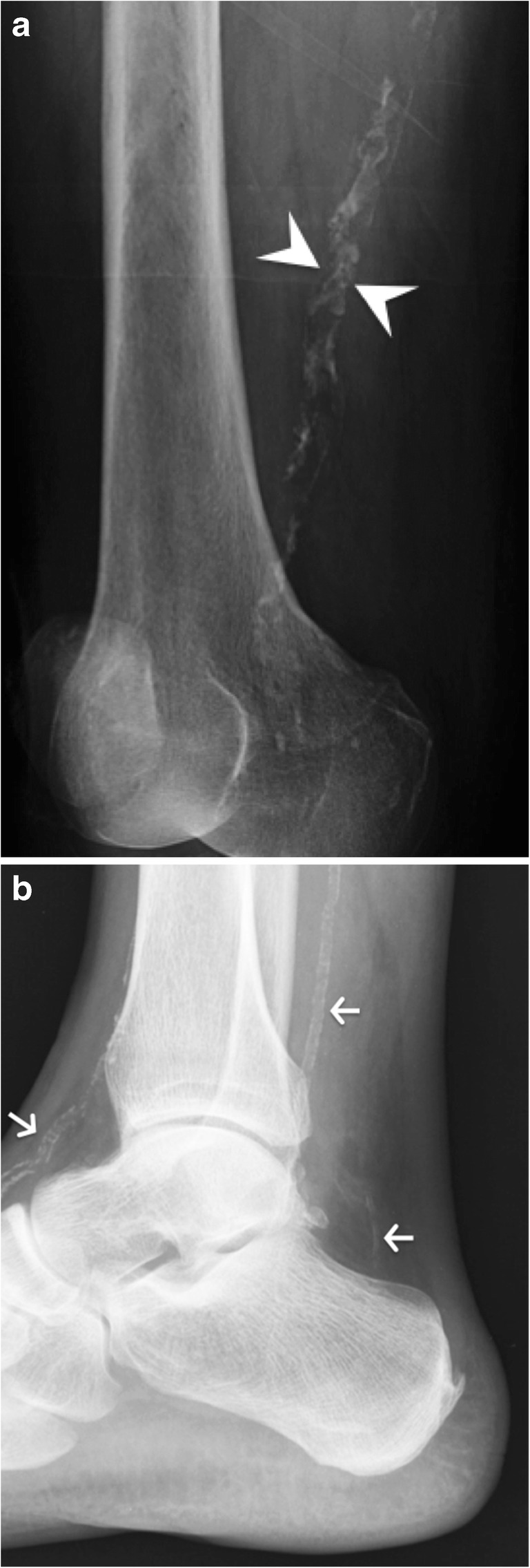 Fig. 21