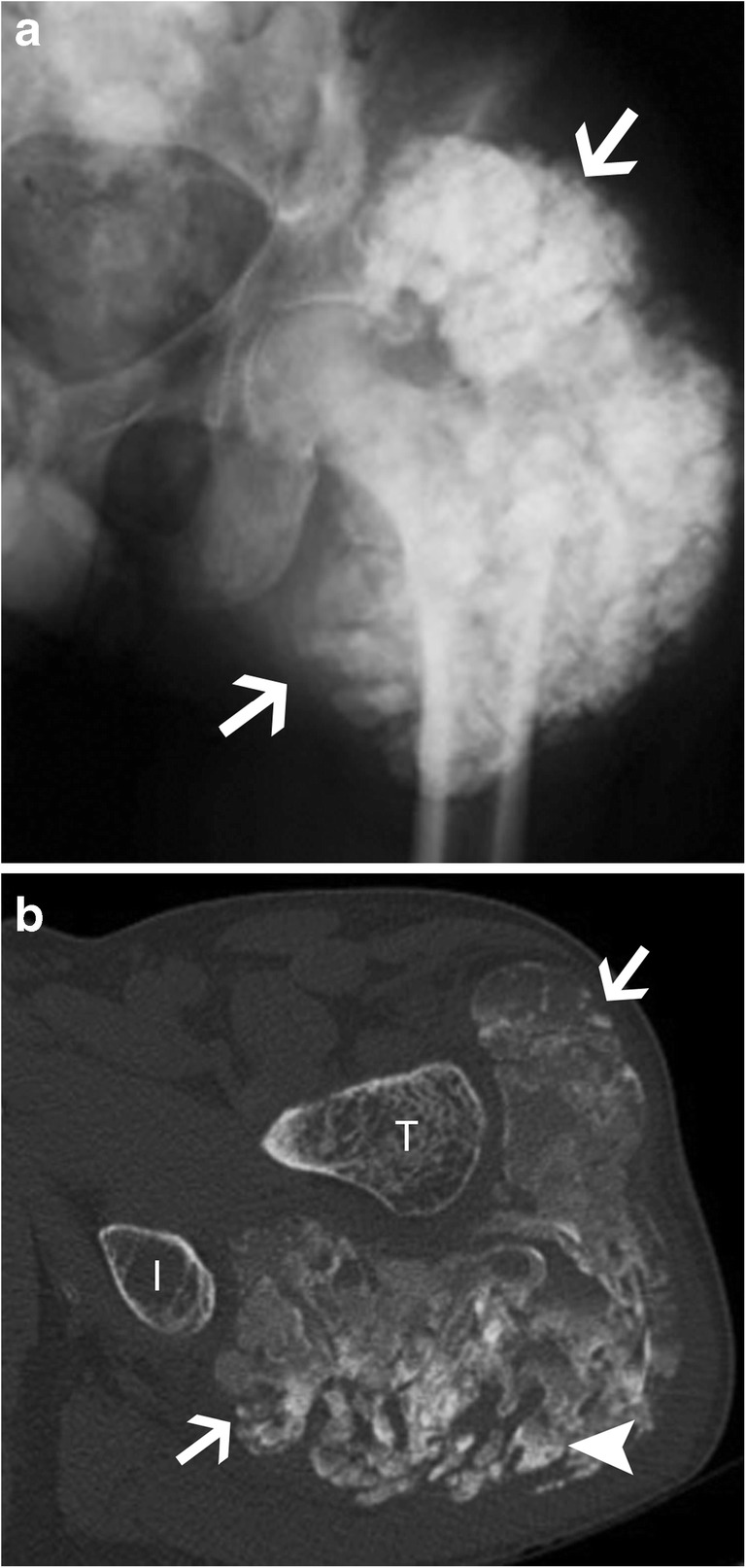 Fig. 18