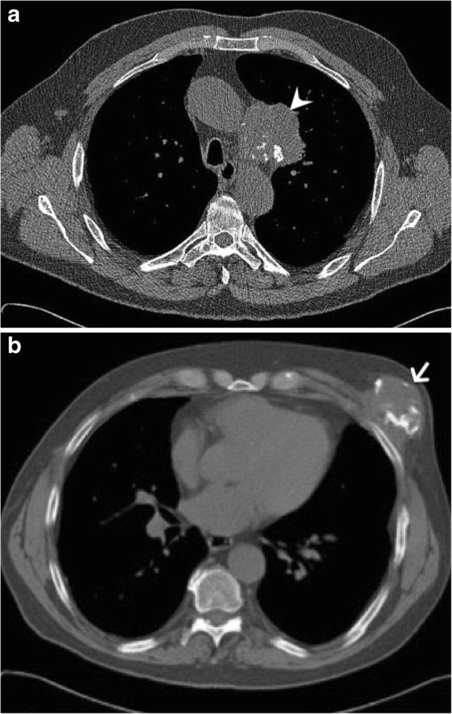 Fig. 26