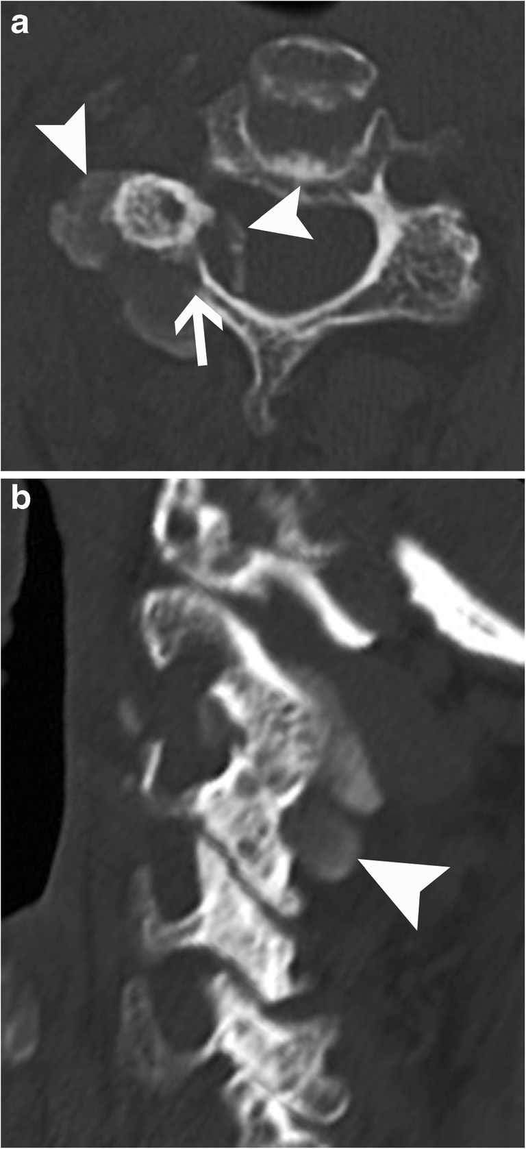 Fig. 15