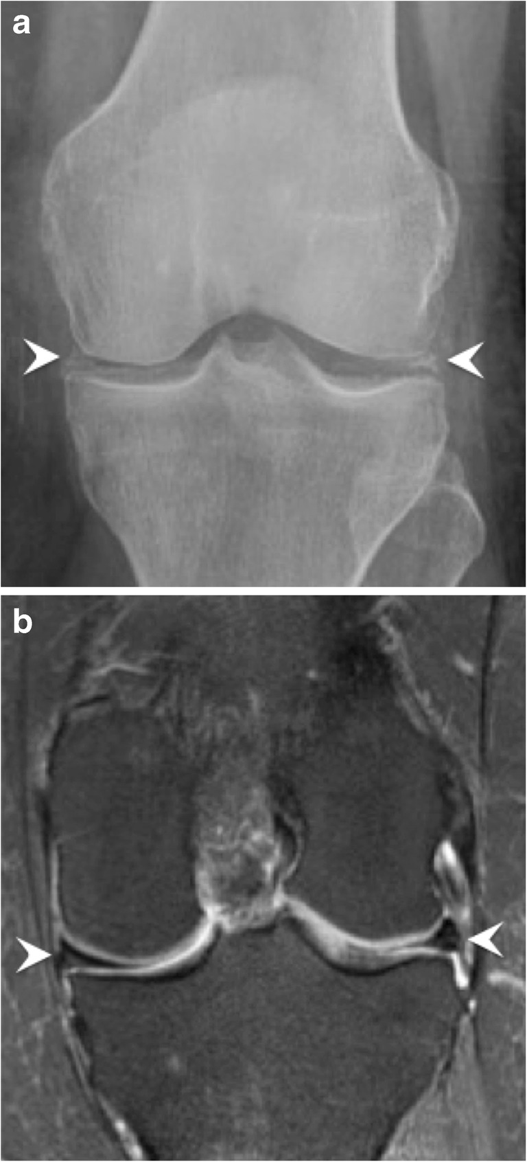 Fig. 11