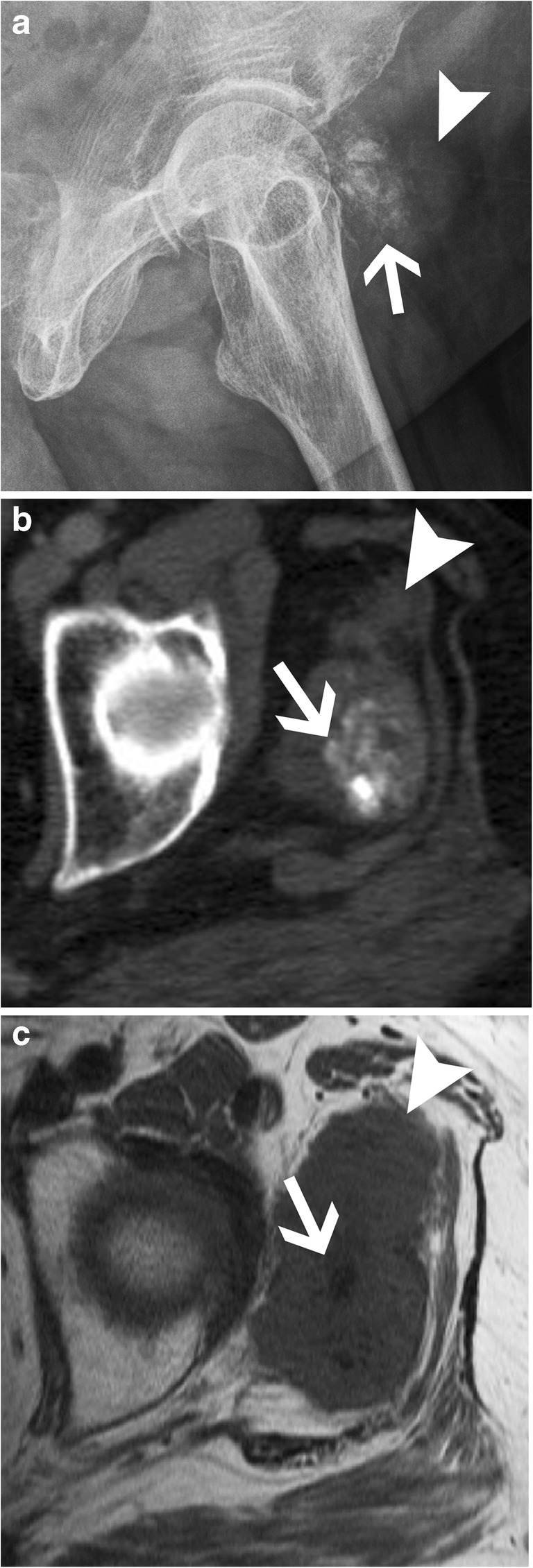 Fig. 25