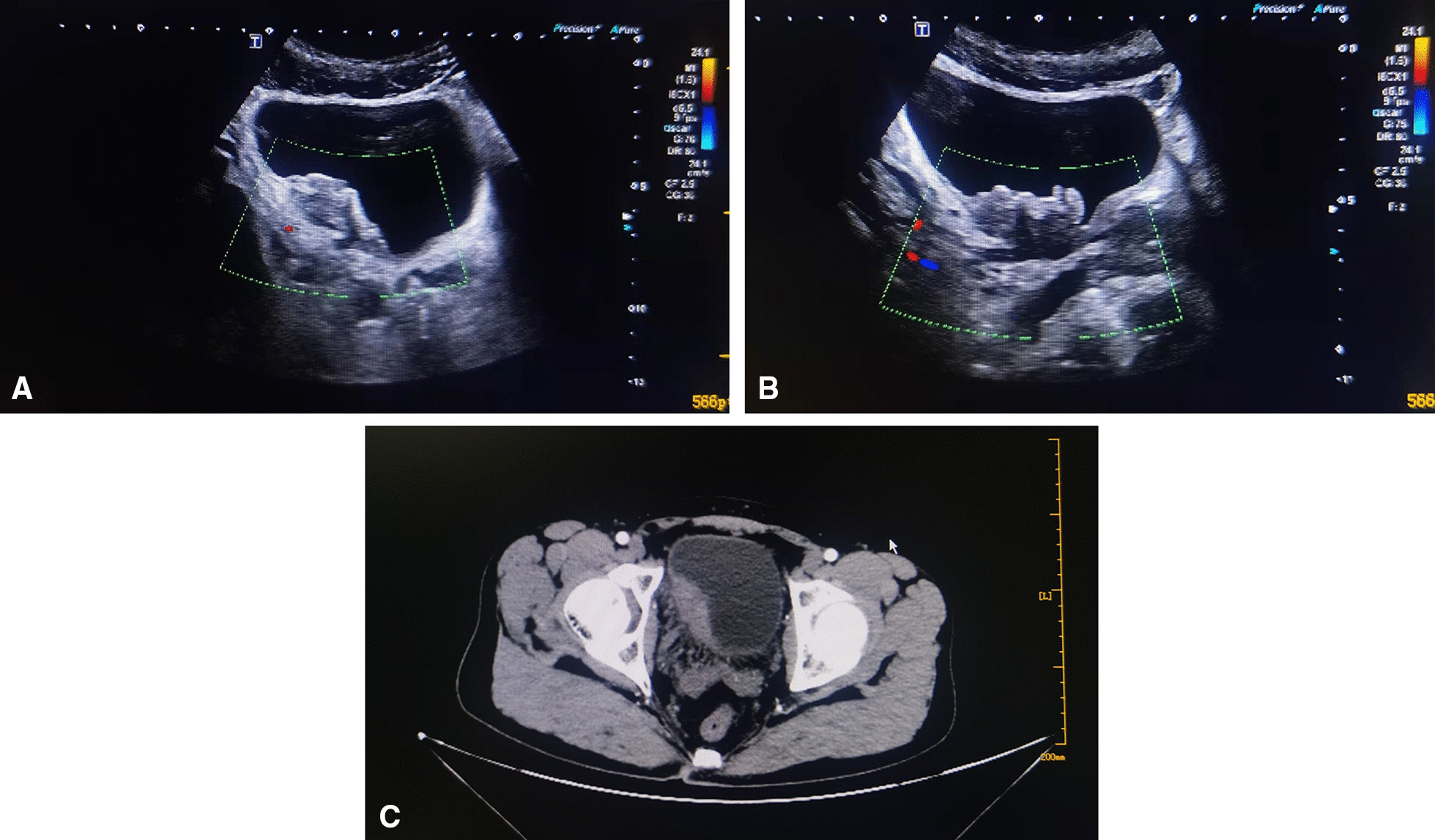 Fig. 1