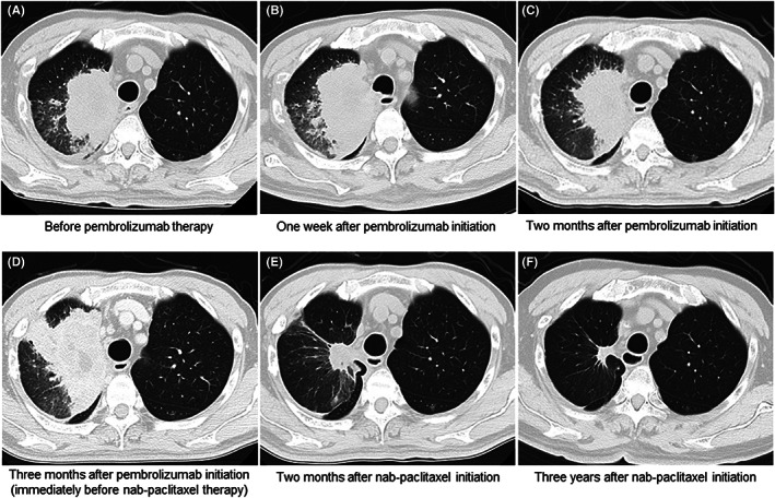 FIGURE 6