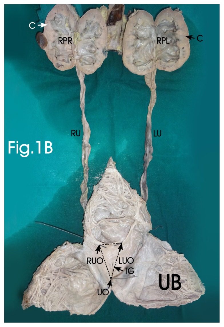 Figure 1B