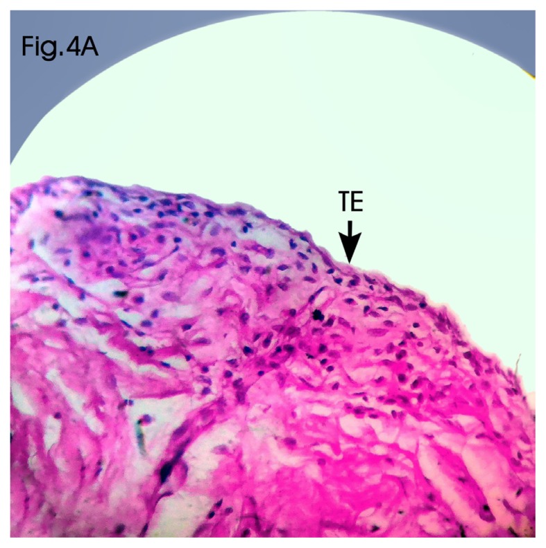 Figure 4A