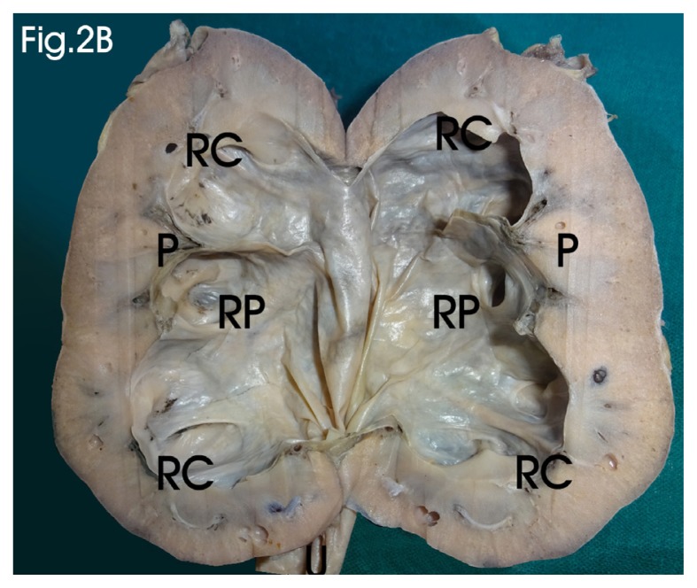 Figure 2B