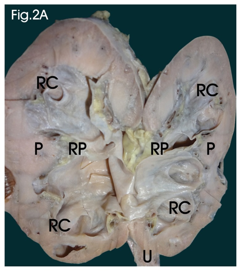 Figure 2A