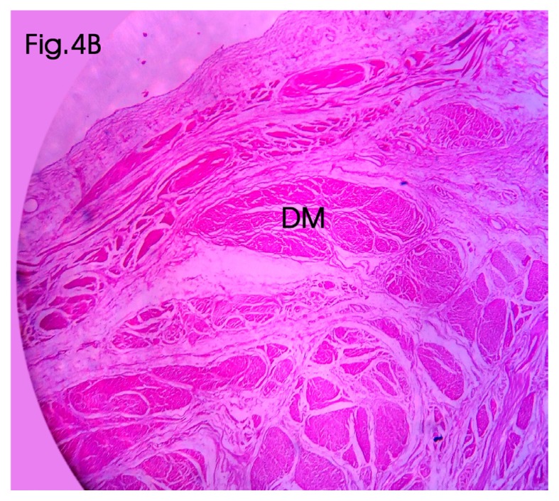 Figure 4B