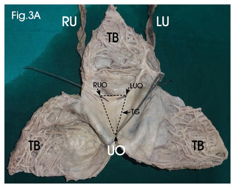 Figure 3A