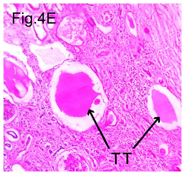 Figure 4E