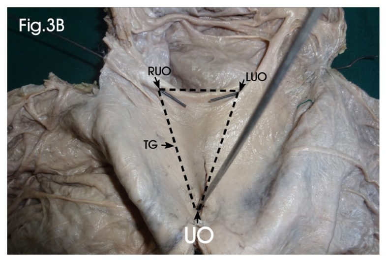 Figure 3B