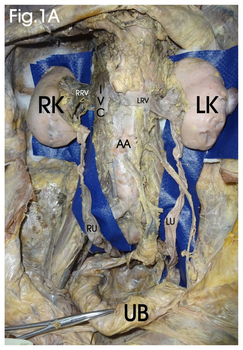 Figure 1A