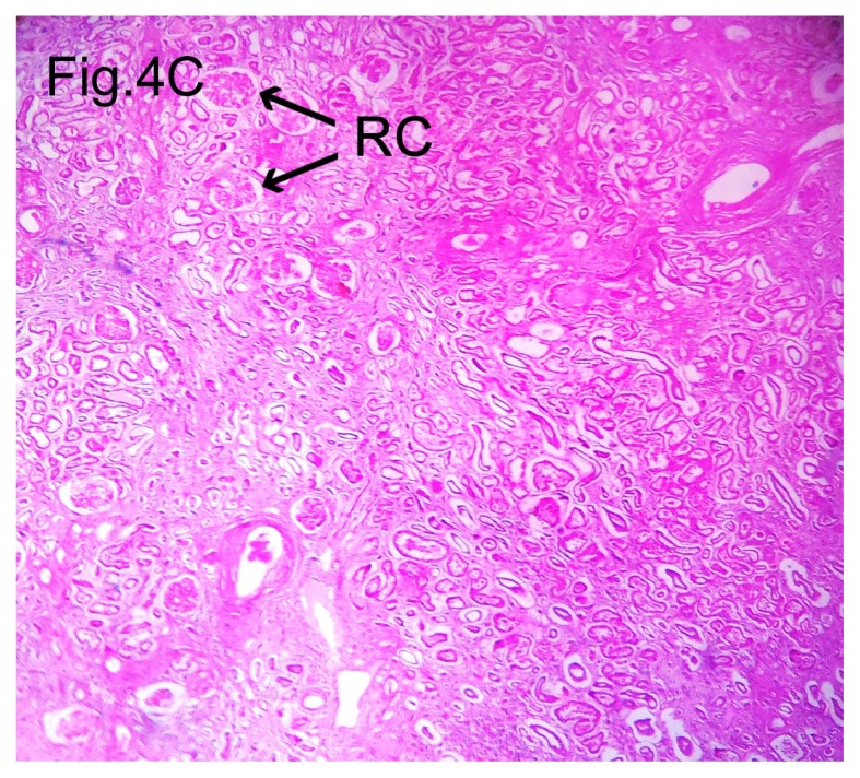 Figure 4C