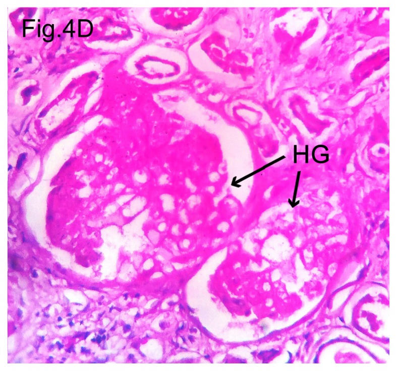 Figure 4D