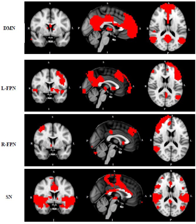 FIGURE 1