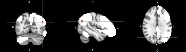 FIGURE 3