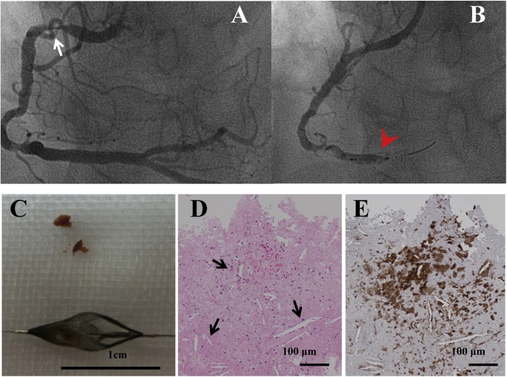 Fig. 2