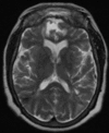 Fig. 10