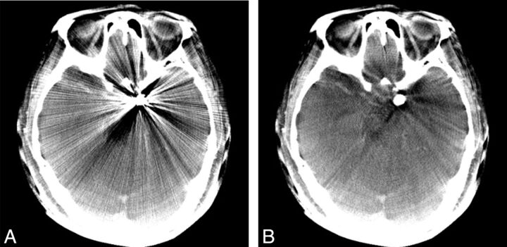 Fig 3.