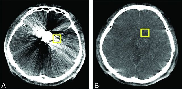 Fig 1.