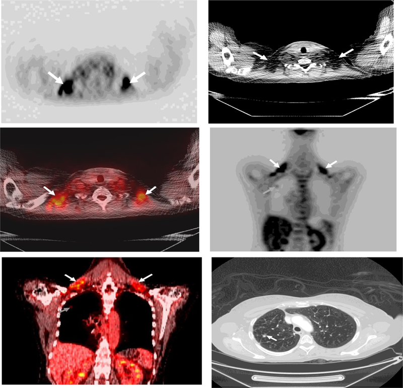 Fig.1