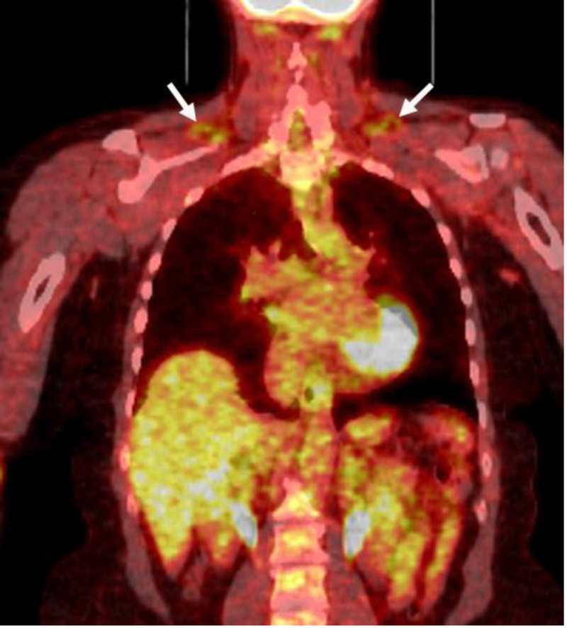 Fig.2