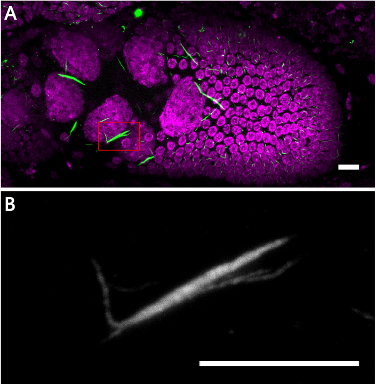 Fig. 11