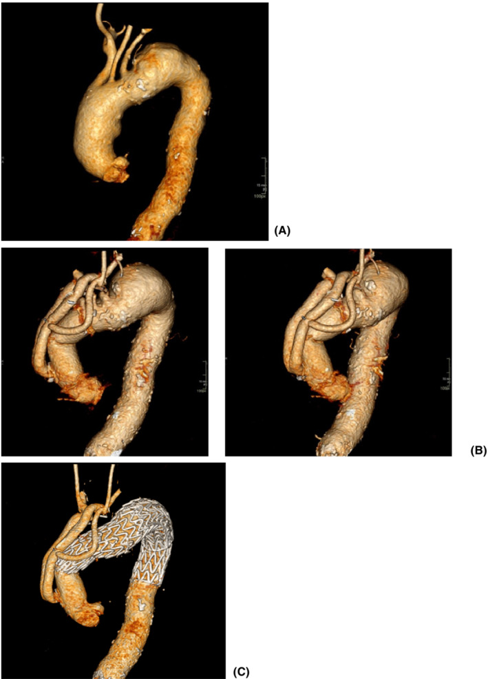 FIGURE 1