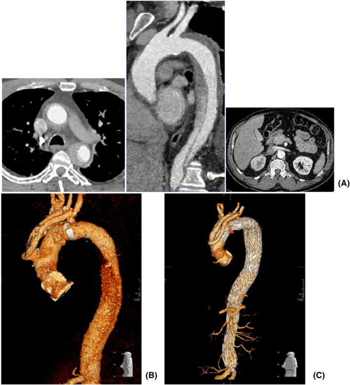 FIGURE 3