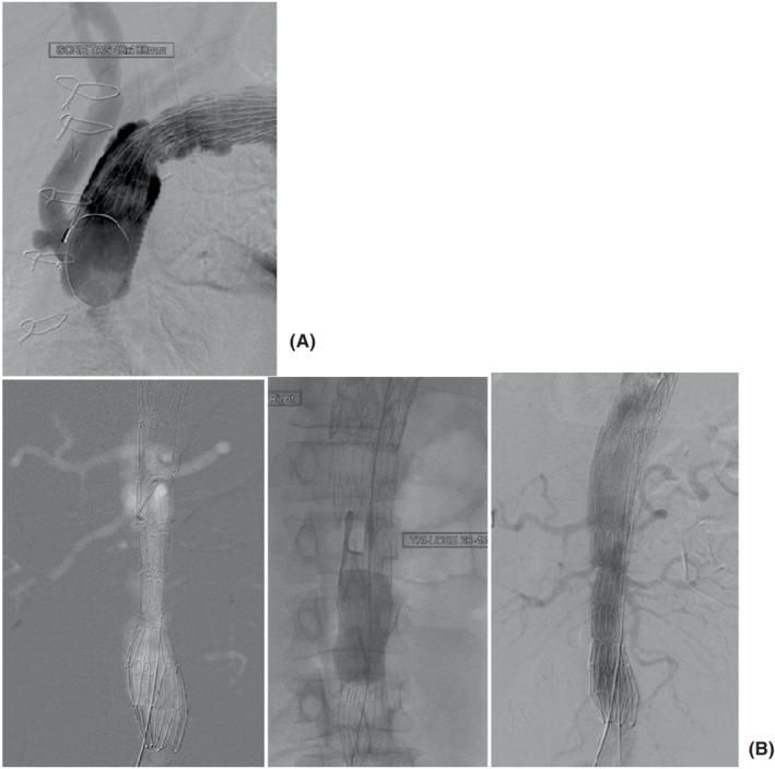 FIGURE 4