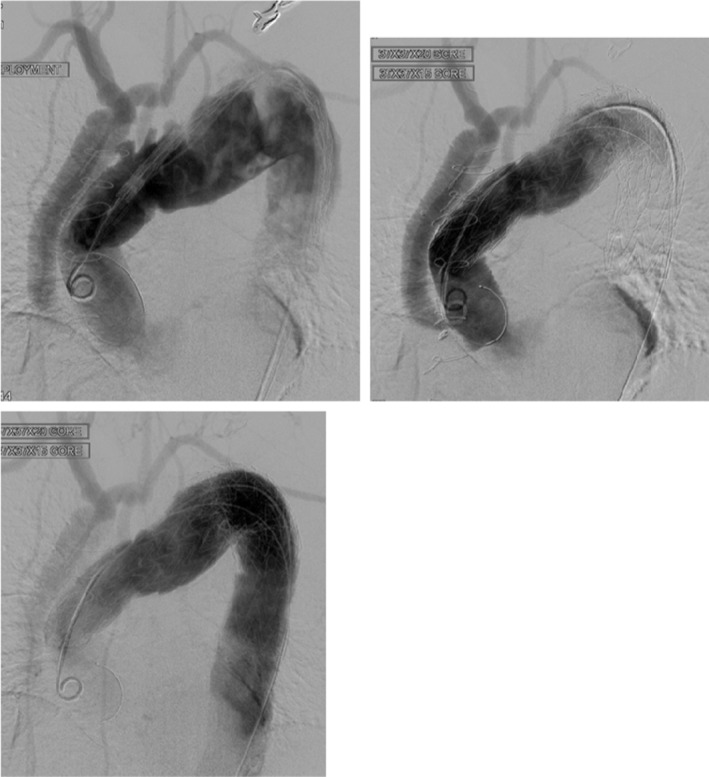 FIGURE 2