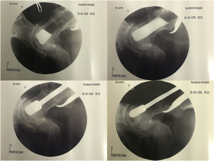 Fig. 2