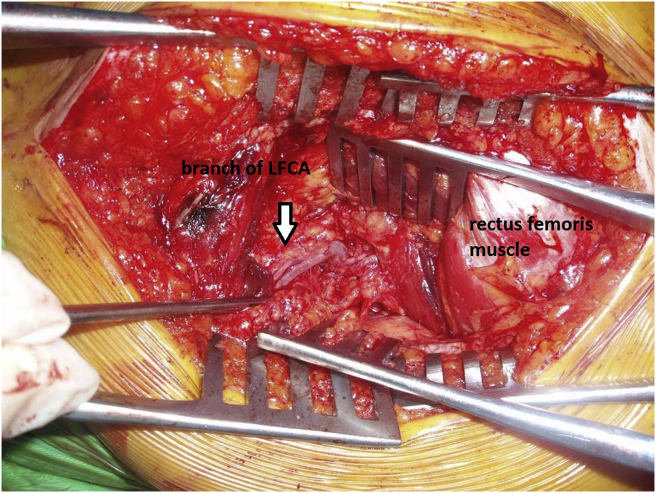 Fig. 3