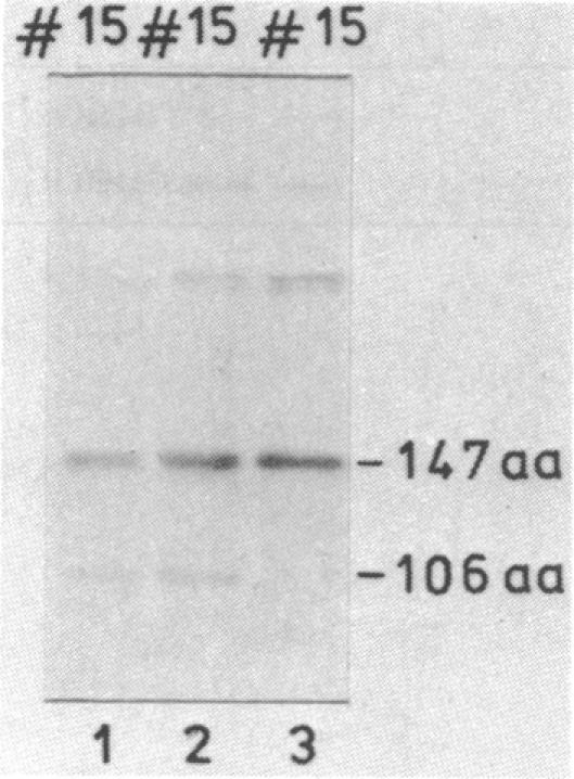 graphic file with name pnas00300-0149-a.jpg