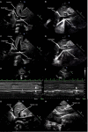 Fig 2