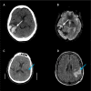 Fig. 4.