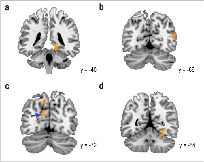 Figure 5—figure supplement 1.