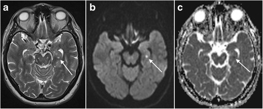 Fig. 23