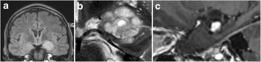 Fig. 19