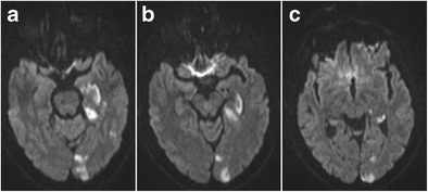 Fig. 21