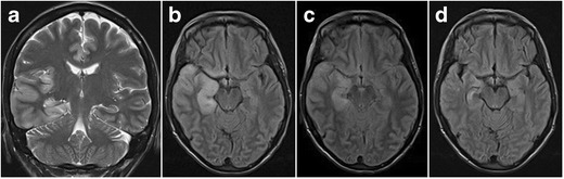 Fig. 24