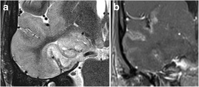 Fig. 15