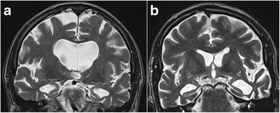 Fig. 13