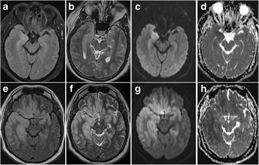 Fig. 14