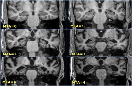 Fig. 12