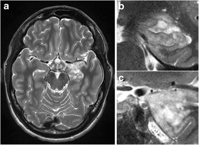 Fig. 20