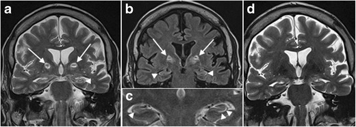 Fig. 26