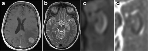 Fig. 25