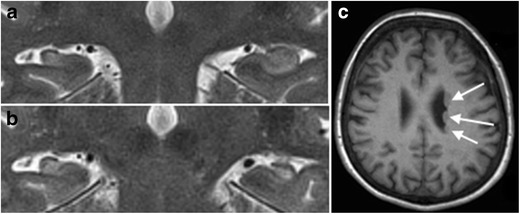 Fig. 11